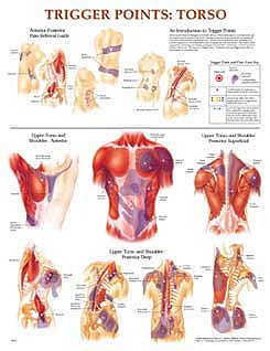  Trigger Points 1 & II Charts (Flexible Lamination) (View larger image)