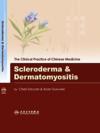  Scleroderma & Dermatomyositis (View larer image)